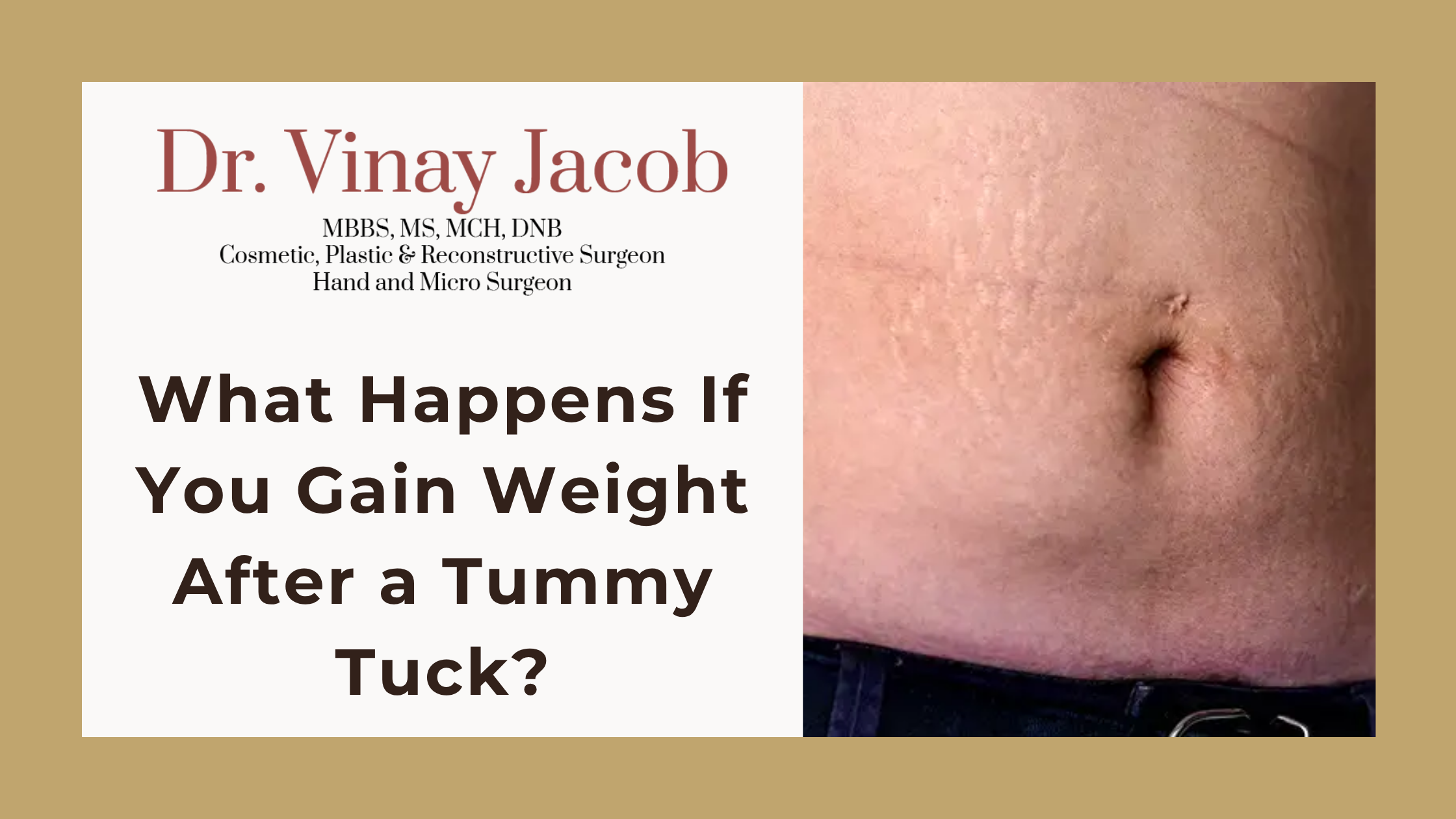 What Happens If You Gain Weight After a Tummy Tuck?